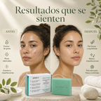 Jabón Facial Serum 10 con Ácido Salicílico y Kójico – Limpieza Detox